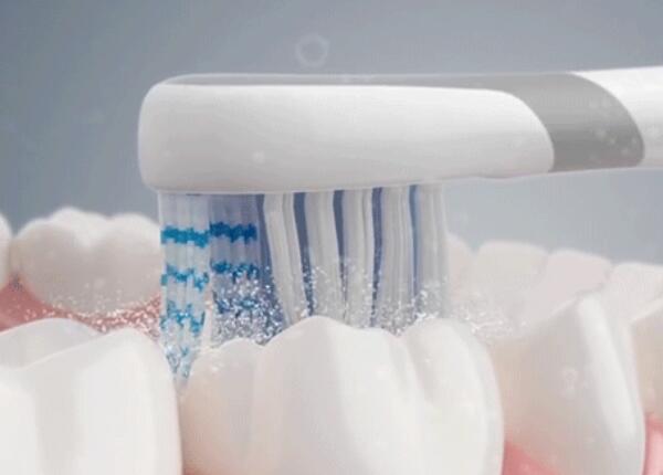 電動牙刷刷牙好嗎？真的比手動牙刷更好嗎？
