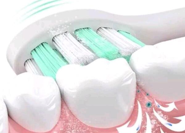 合適牙刷頭選擇 合適牙刷頭選擇